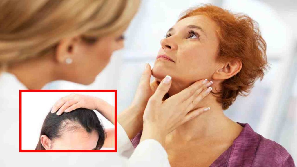 hypothyroidism