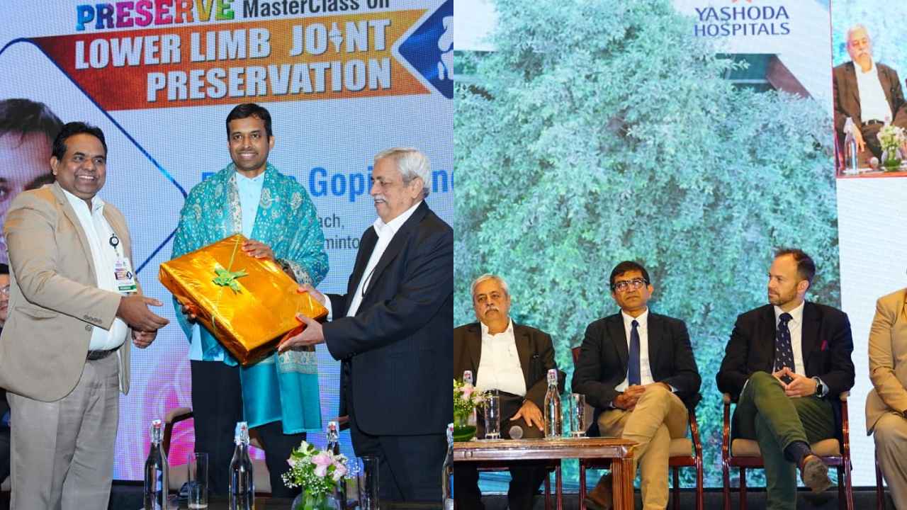 Joint Preservation : గుడ్ న్యూస్.. జాయింట్ ప్రిజర్వేషన్తో ఇక కీలు మార్పిడికి నో చెబుదాం..! Joint Preservation : గుడ్ న్యూస్.. జాయింట్ ప్రిజర్వేషన్తో ఇక కీలు మార్పిడికి నో చెబుదాం..!