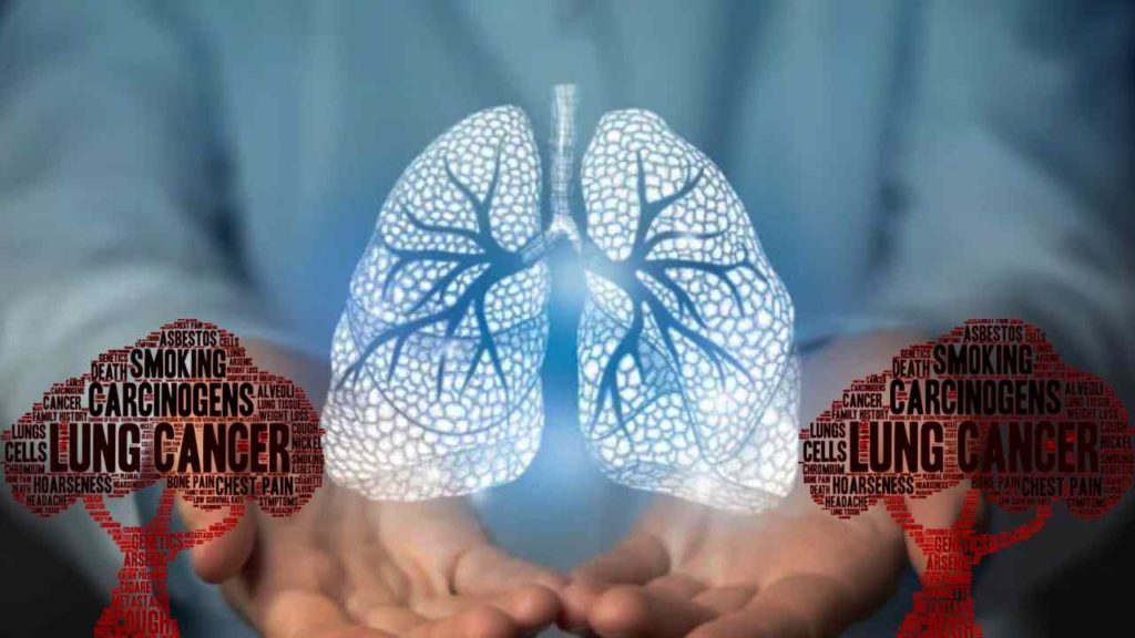 LUNG CANCER