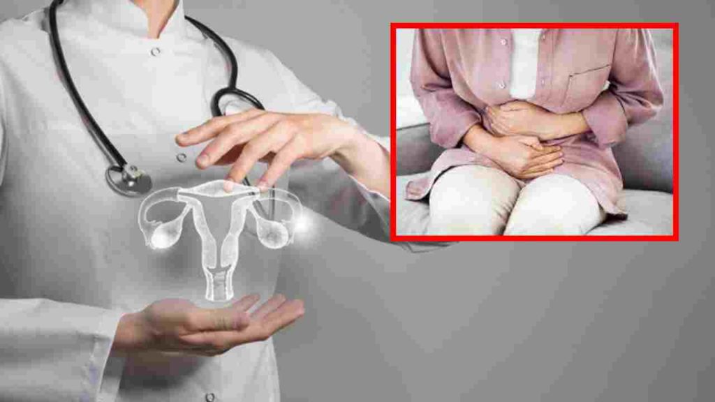 Polycystic Ovary Syndrome