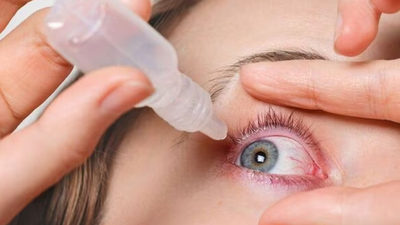Eye Flu: యువతలో కండ్లకలక 49% పెరిగిందని చెబుతున్న తాజా సర్వే Eye Flu: యువతలో కండ్లకలక 49% పెరిగిందని చెబుతున్న తాజా సర్వే