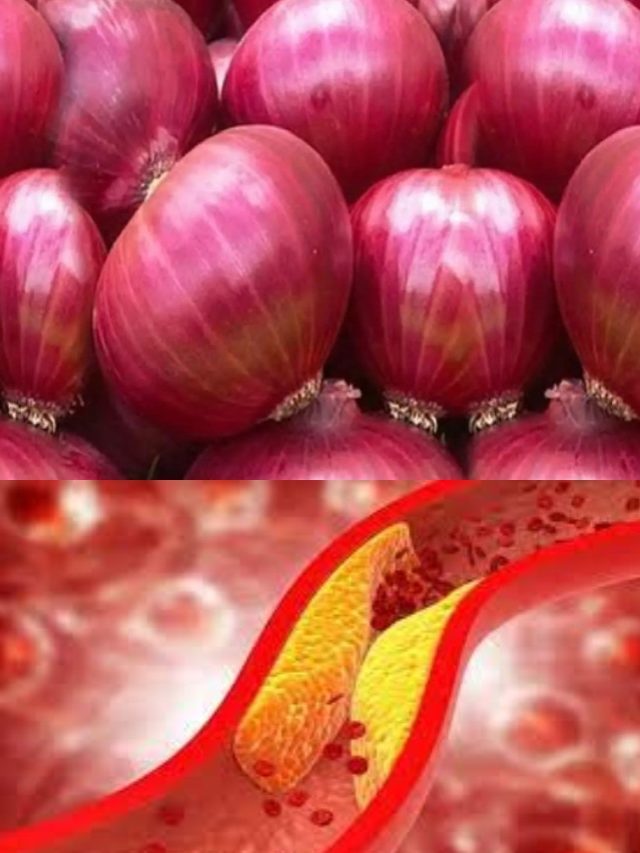 >ఉల్లిపాయలు తినడం వల్ల కొలెస్ట్రాల్ స్థాయి అదుపులో ఉంటుందా?