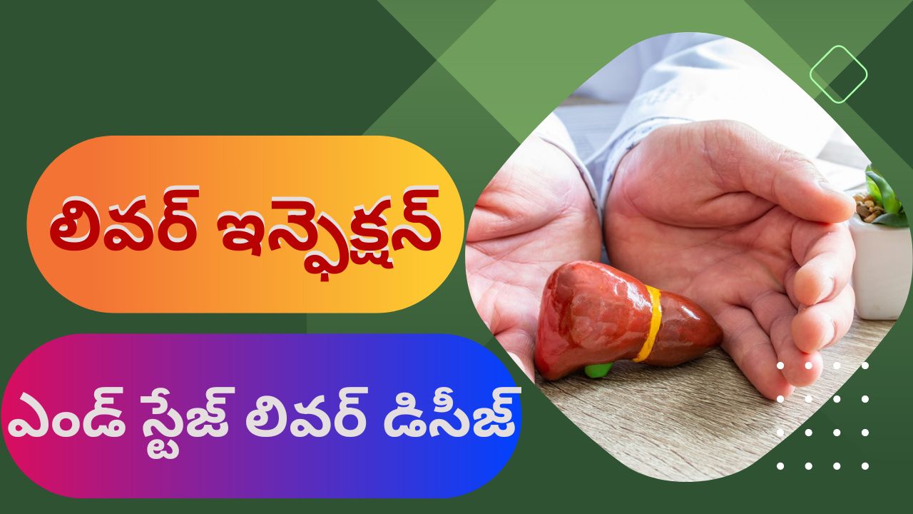 ఎండ్ స్టేజ్ లివర్ డిసీజ్ లో ఎలాంటి లక్షణాలు కనిపిస్తాయో తెలుసా ? ఎండ్ స్టేజ్ లివర్ డిసీజ్ లో ఎలాంటి లక్షణాలు కనిపిస్తాయో తెలుసా ?