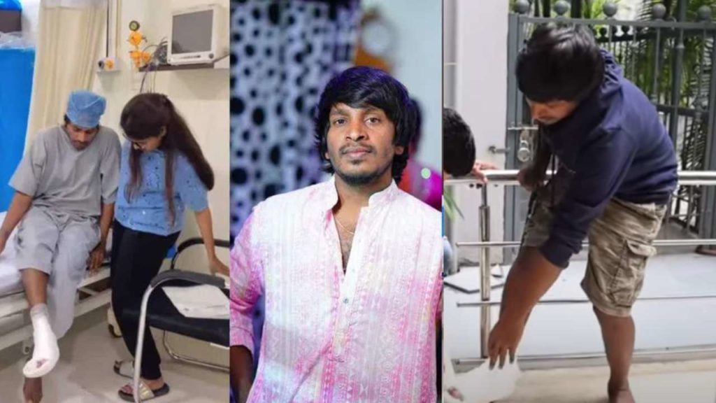 Yadamma Raju Leg Finger Removed in Operation raju emotional in Interview