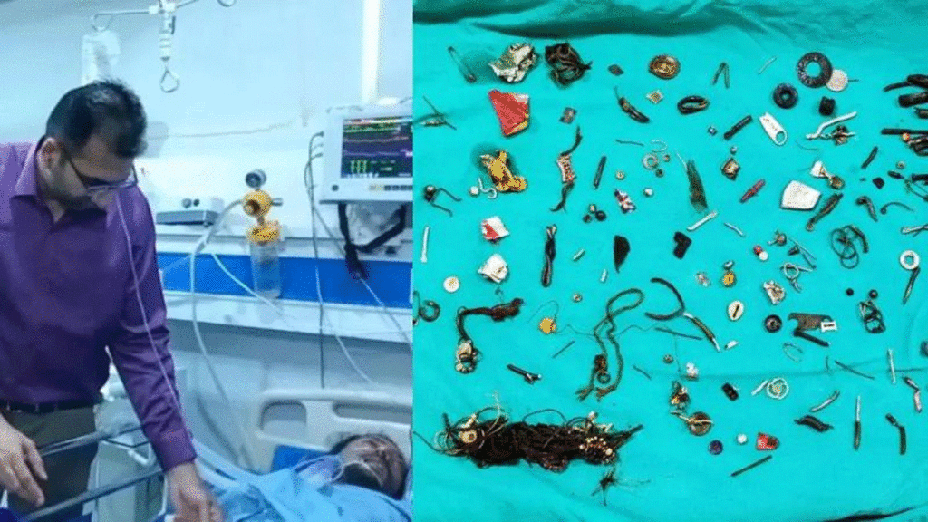 100 Items Pulled From Mans Stomach