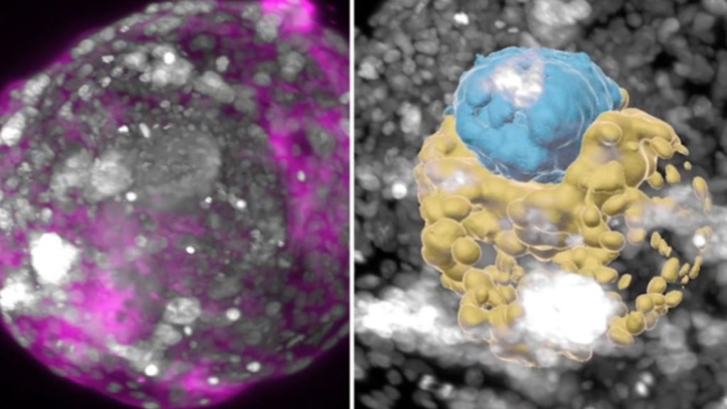 Human Embryos