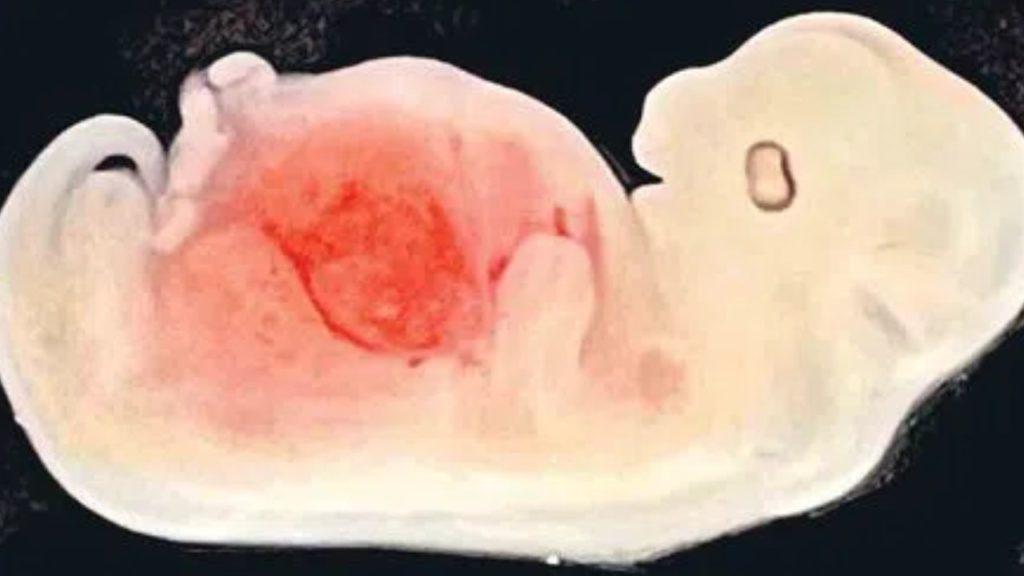 Human Kidney In Pig Embryo