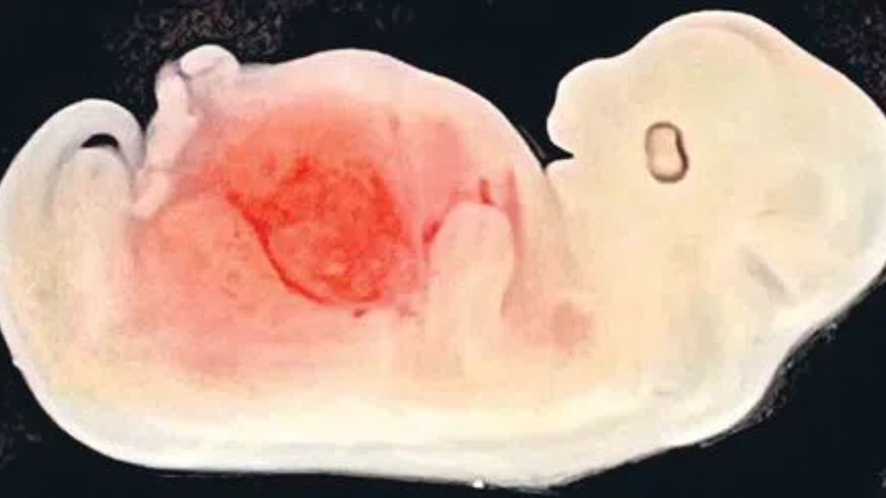 Pig Embryo : పంది పిండంలో మానవ మూత్రపిండం అభివృద్ధి.. చైనా పరిశోధకులు అద్భుతం Pig Embryo : పంది పిండంలో మానవ మూత్రపిండం అభివృద్ధి.. చైనా పరిశోధకులు అద్భుతం