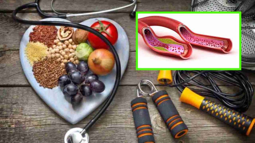 cholesterol foods