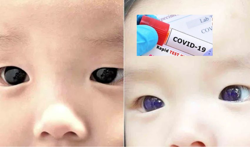covid 19 treatment