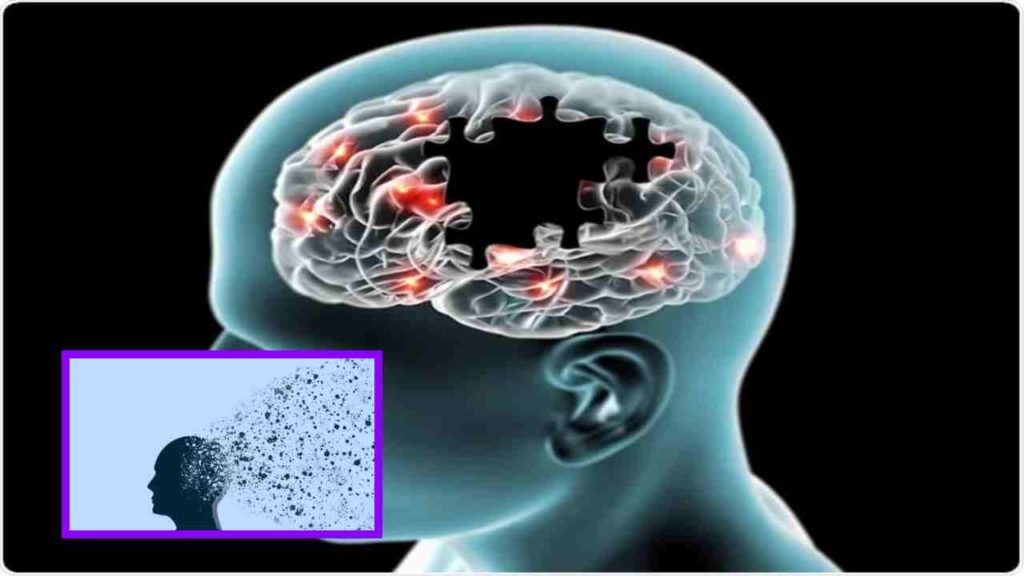 alzheimer's
