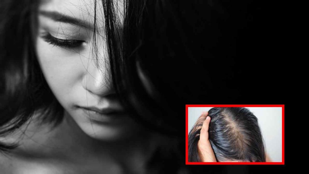 hair regeneration