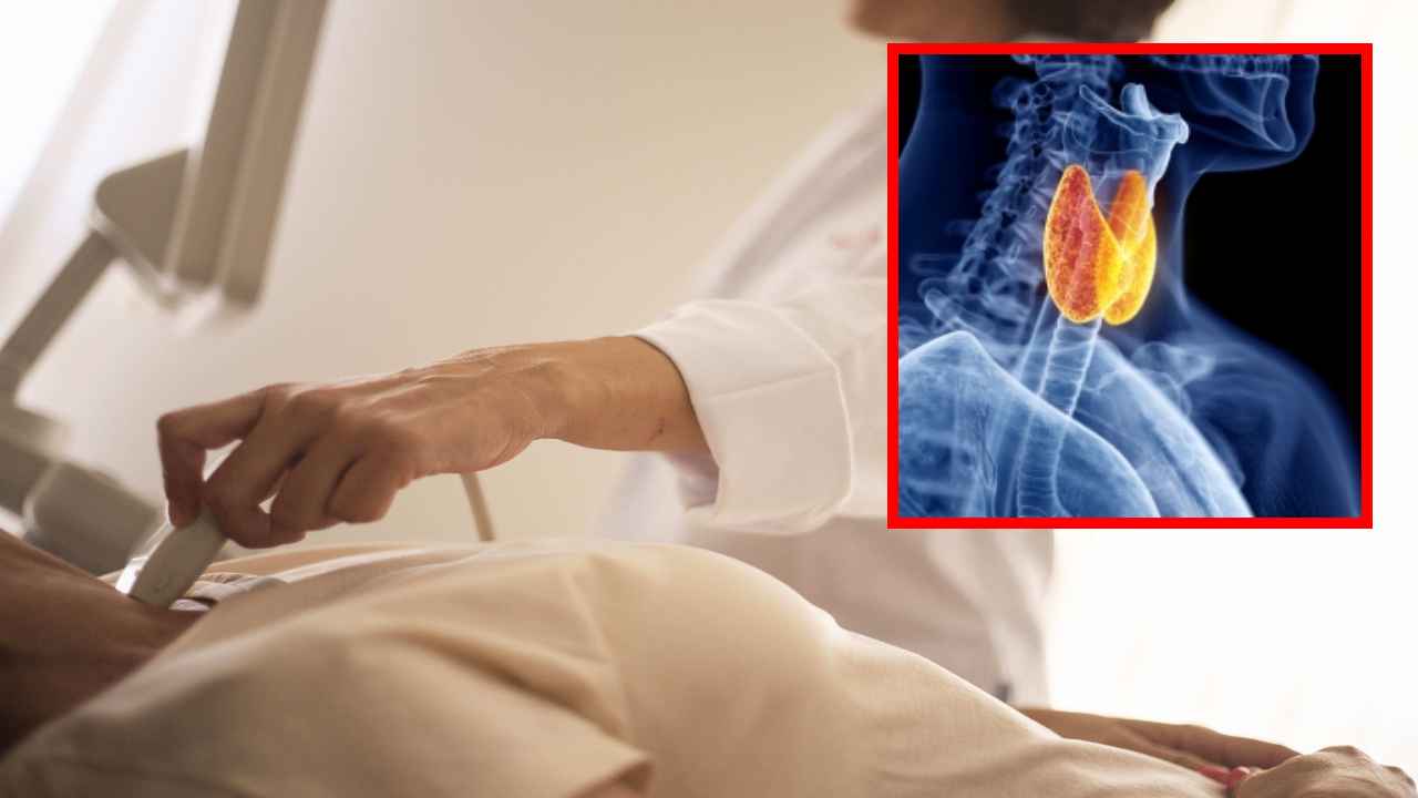 Thyroid Problems : థైరాయడ్ సమస్యతో బాధపడుతున్నవారు తీసుకునే ఆహారం విషయంలో తీసుకోవాల్సిన జాగ్రత్తలు ! Thyroid Problems : థైరాయడ్ సమస్యతో బాధపడుతున్నవారు తీసుకునే ఆహారం విషయంలో తీసుకోవాల్సిన జాగ్రత్తలు !