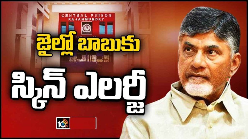 Treatment For Chandrababu In Jail