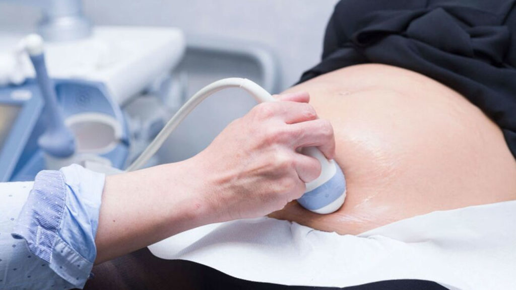 Woman sues fertility doctor alleges he secretly inseminated his sperm 34 years ago