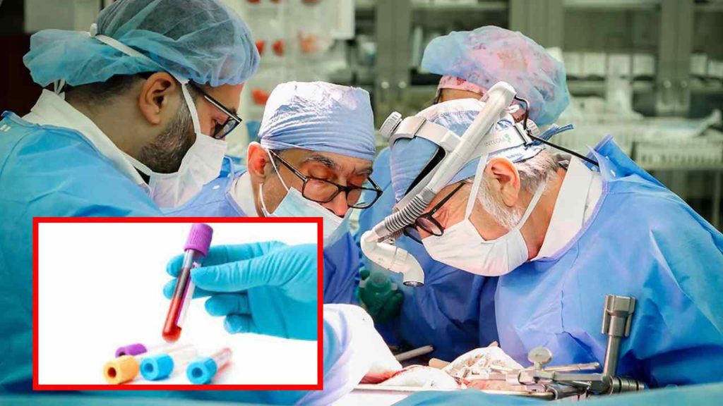 organ donation