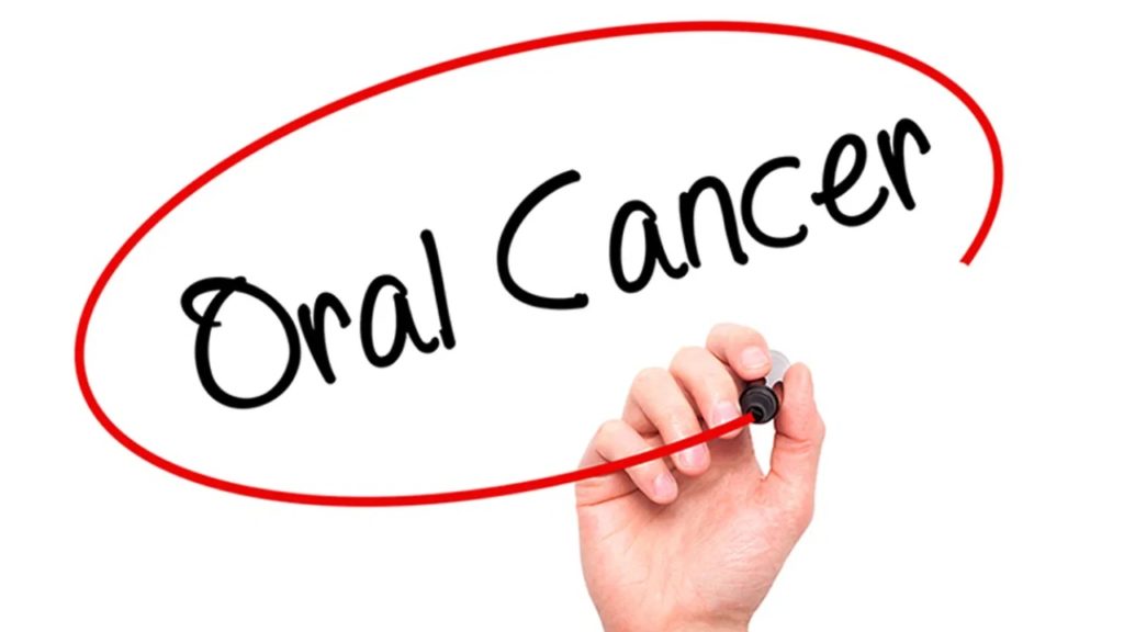 smart phone detect Oral Cancer