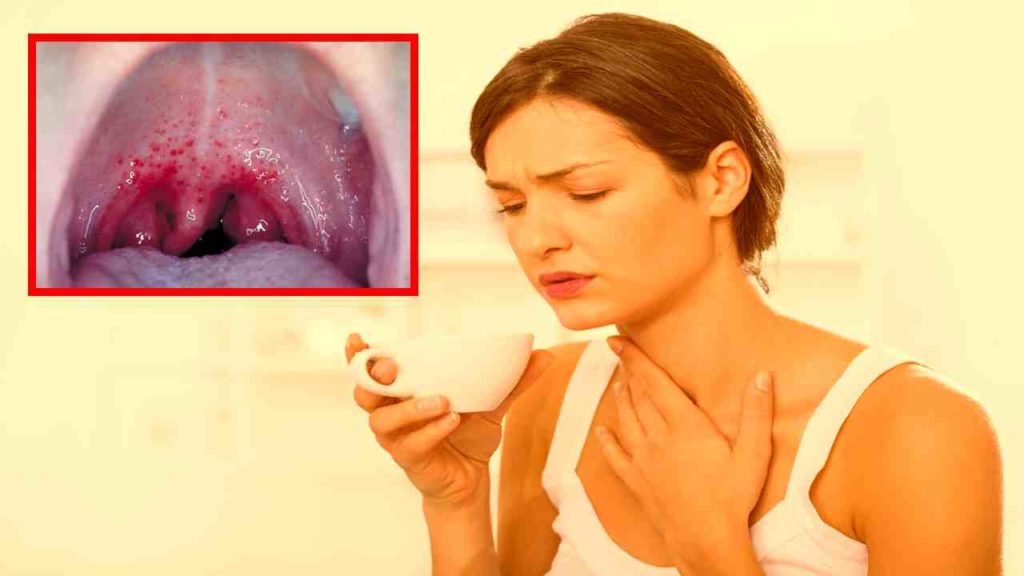 sore throat