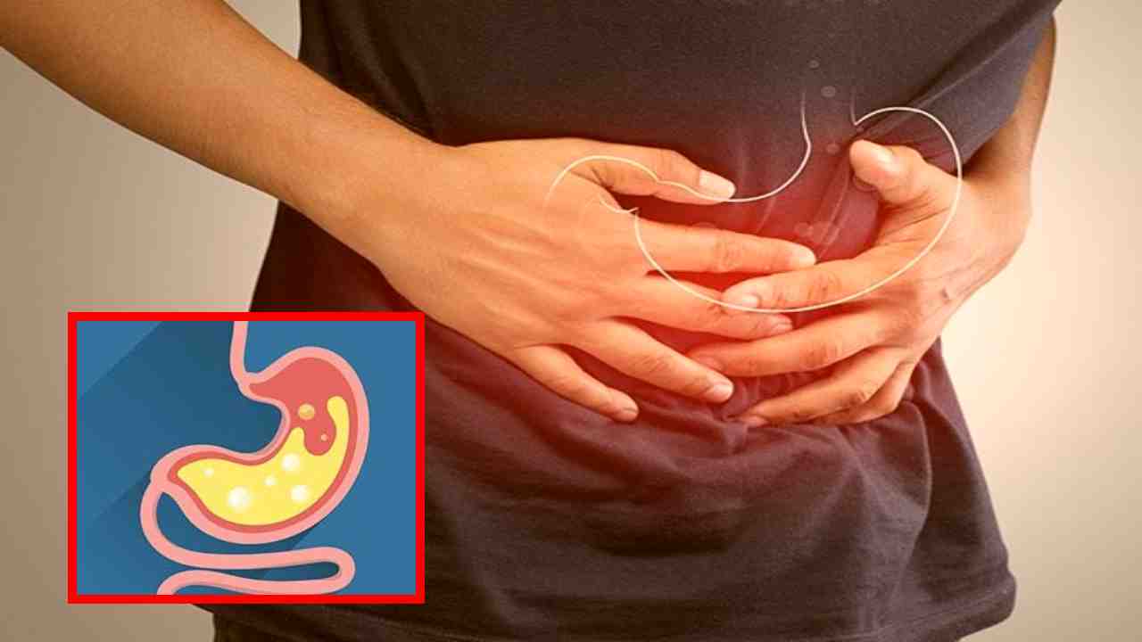 Gastric problems : గ్యాస్ట్రిక్ సమస్యలు కారణాలు, చికిత్స ! Gastric problems : గ్యాస్ట్రిక్ సమస్యలు కారణాలు, చికిత్స !