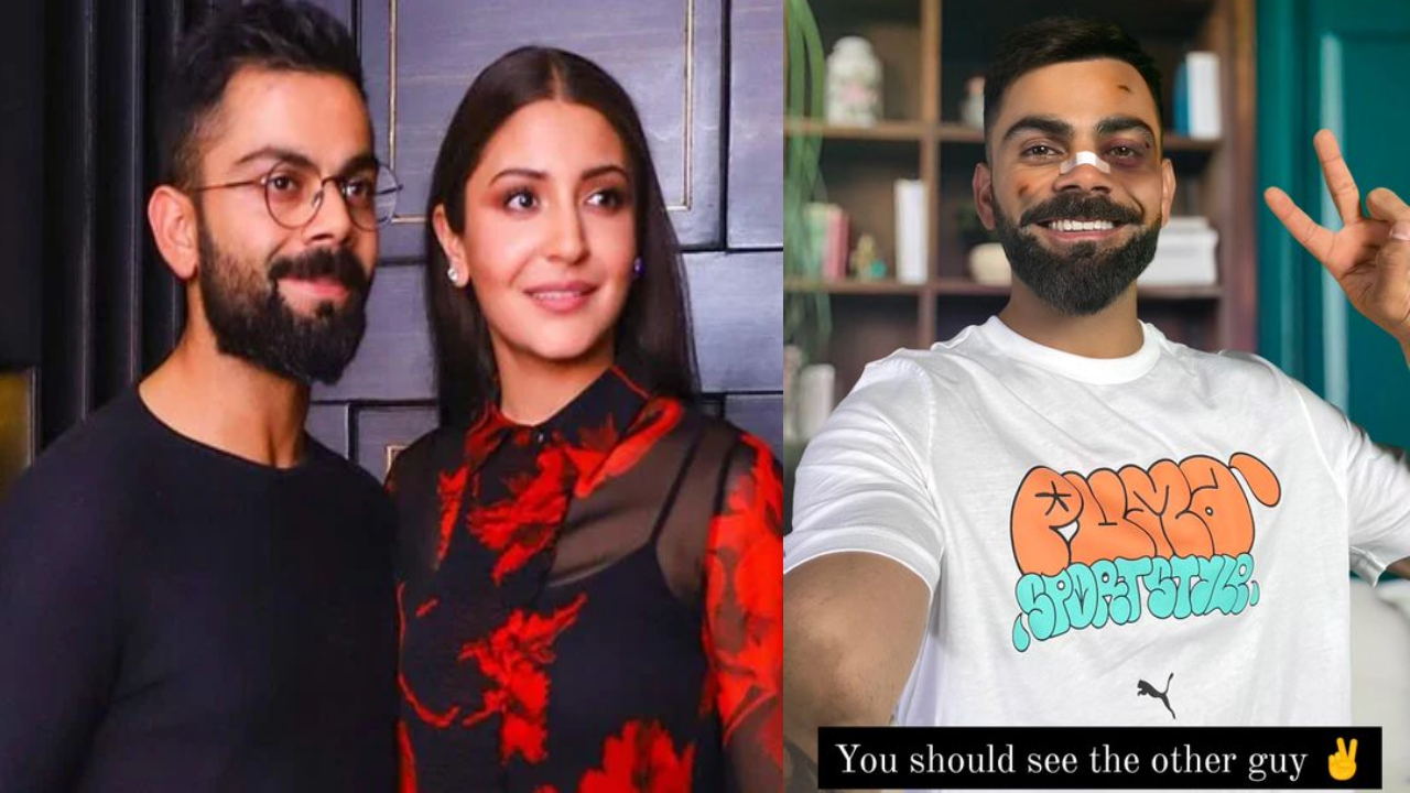 Virat – Anushka : విరాట్ కోహ్లీని అనుష్క శర్మ కొట్టిందా.. గాయాలతో కింగ్ పిక్.. Virat – Anushka : విరాట్ కోహ్లీని అనుష్క శర్మ కొట్టిందా.. గాయాలతో కింగ్ పిక్..