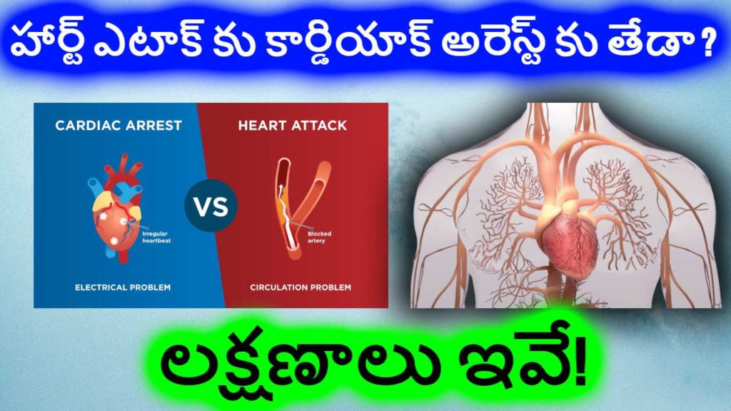 Heart attack vs cardiac arrest