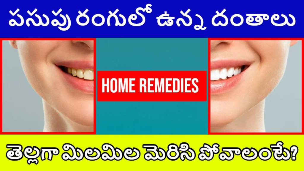 Home Remedies