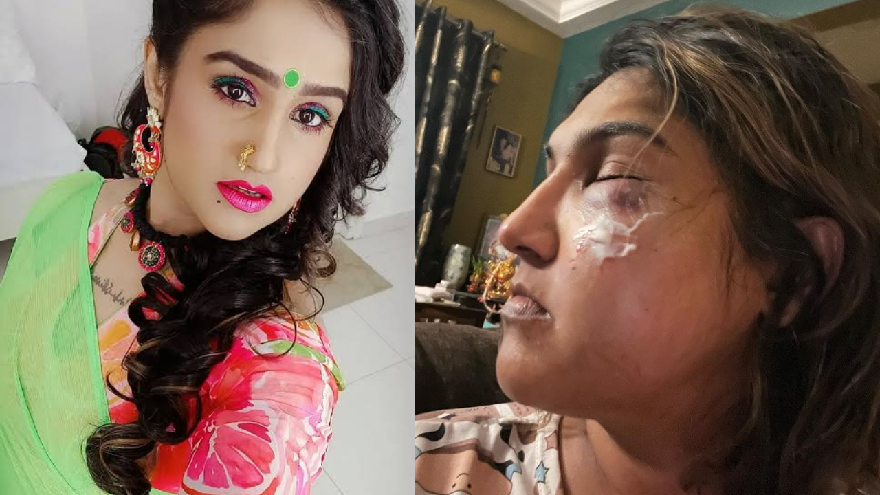 Vanitha Vijay Kumar : గాయాలతో తమిళ యాక్ట్రెస్ పోస్ట్.. బిగ్బాస్ వలనే దాడి జరిగిందా..? Vanitha Vijay Kumar : గాయాలతో తమిళ యాక్ట్రెస్ పోస్ట్.. బిగ్బాస్ వలనే దాడి జరిగిందా..?