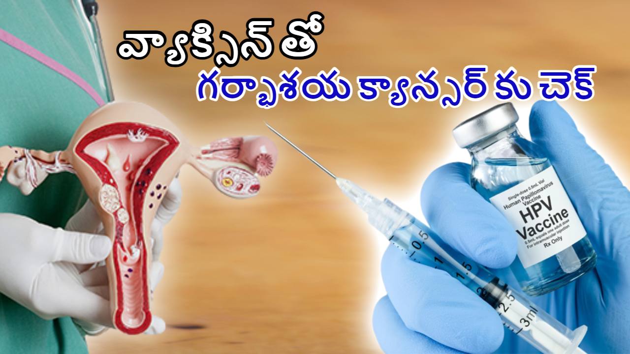 Cervical Cancer : గర్భాశయ క్యాన్సర్ ను ముందస్తు వ్యాక్సిన్ తో అరికట్టవచ్చా ? Cervical Cancer : గర్భాశయ క్యాన్సర్ ను ముందస్తు వ్యాక్సిన్ తో అరికట్టవచ్చా ?