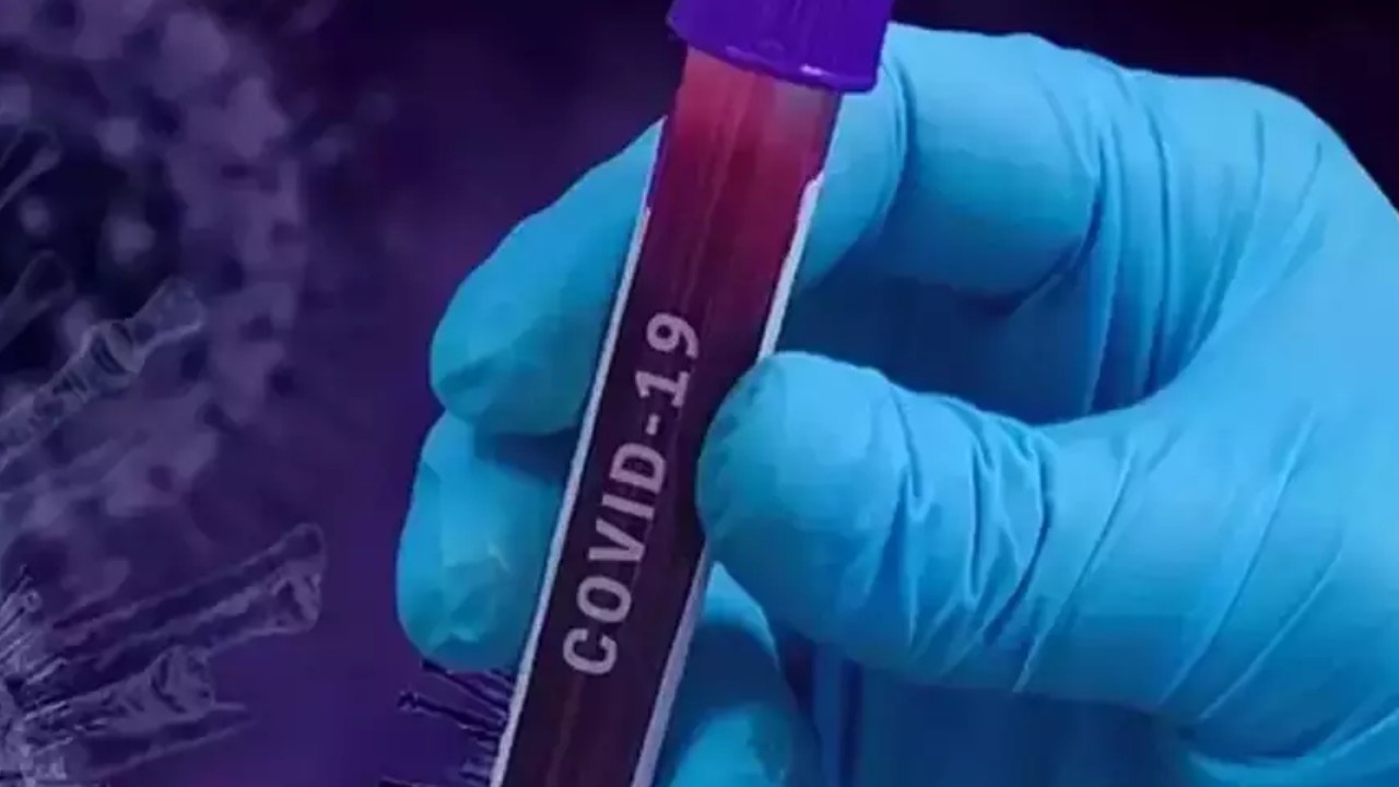 Corona virus: విశాఖ ప్రజలను కలవరపెడుతున్న కరోనా.. పెరుగుతున్న కొవిడ్ కేసులు Corona virus: విశాఖ ప్రజలను కలవరపెడుతున్న కరోనా.. పెరుగుతున్న కొవిడ్ కేసులు