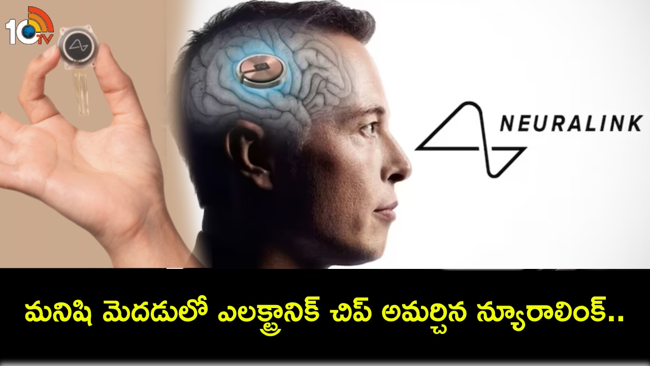 మనిషి మెదడులో ఎలక్ట్రానిక్ చిప్ అమర్చిన న్యూరాలింక్.. ఈ డివైజ్ ఎలా పనిచేస్తుంది? మస్క్ ఏమన్నారంటే? మనిషి మెదడులో ఎలక్ట్రానిక్ చిప్ అమర్చిన న్యూరాలింక్.. ఈ డివైజ్ ఎలా పనిచేస్తుంది? మస్క్ ఏమన్నారంటే?