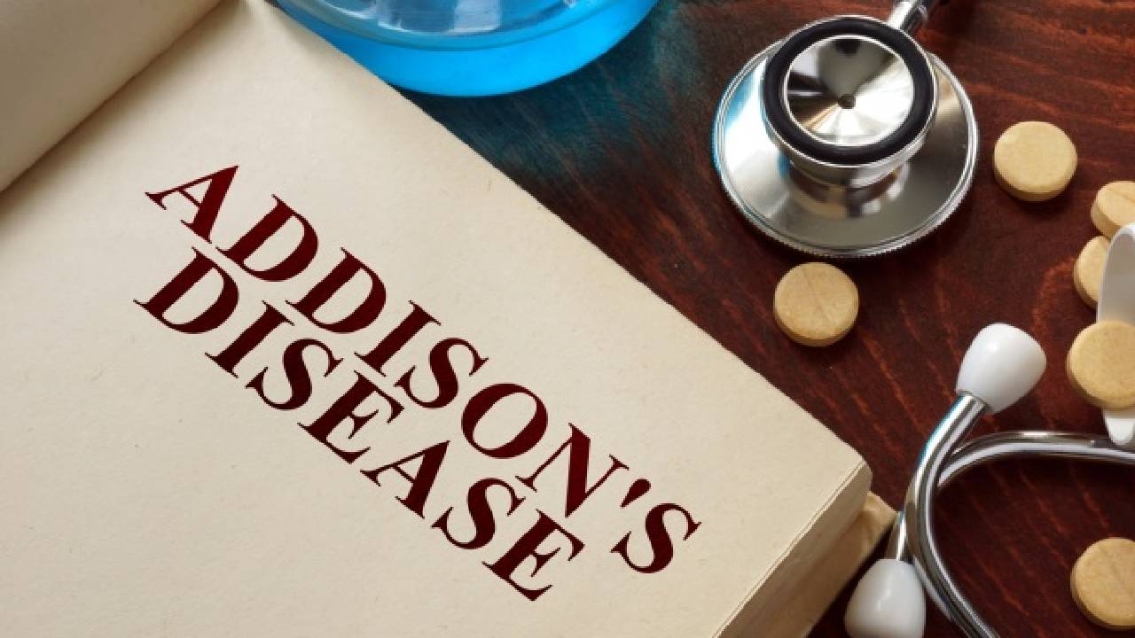 Addisons Disease : ఆడిసన్స్ వ్యాధితో బాధపడ్డ స్టార్ హీరోయిన్.. చిన్నప్పటి విషయాలు గుర్తు రావడం లేదట.. Addisons Disease : ఆడిసన్స్ వ్యాధితో బాధపడ్డ స్టార్ హీరోయిన్.. చిన్నప్పటి విషయాలు గుర్తు రావడం లేదట..