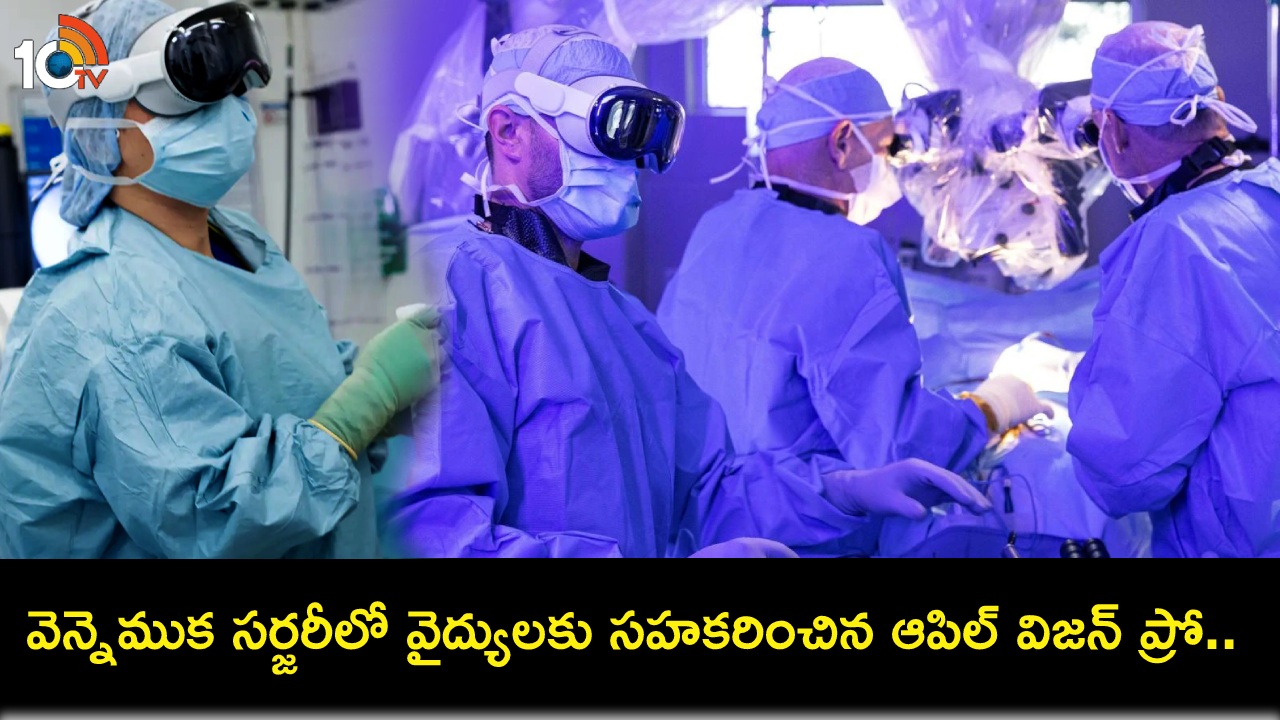 Apple Vision Pro : వైద్య రంగంలో విజన్ ప్రో వినియోగం.. వెన్నెముక ఆపరేషన్లో వైద్యులకు సహకరించిన ఆపిల్ వీఆర్ హెడ్సెట్! Apple Vision Pro : వైద్య రంగంలో విజన్ ప్రో వినియోగం.. వెన్నెముక ఆపరేషన్లో వైద్యులకు సహకరించిన ఆపిల్ వీఆర్ హెడ్సెట్!