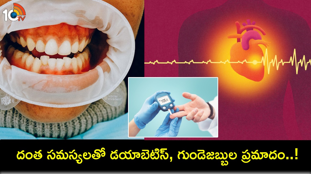 Brushing Your Teeth : మీ పళ్లను ఇలా బ్రష్ చేస్తున్నారా? దంత సమస్యలతో డయాబెటిస్, గుండెజబ్బుల ప్రమాదం..! Brushing Your Teeth : మీ పళ్లను ఇలా బ్రష్ చేస్తున్నారా? దంత సమస్యలతో డయాబెటిస్, గుండెజబ్బుల ప్రమాదం..!