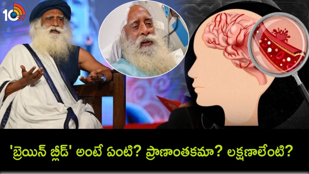 What is 'brain bleed' that Sadhguru recovering from, Symptoms And Prevention