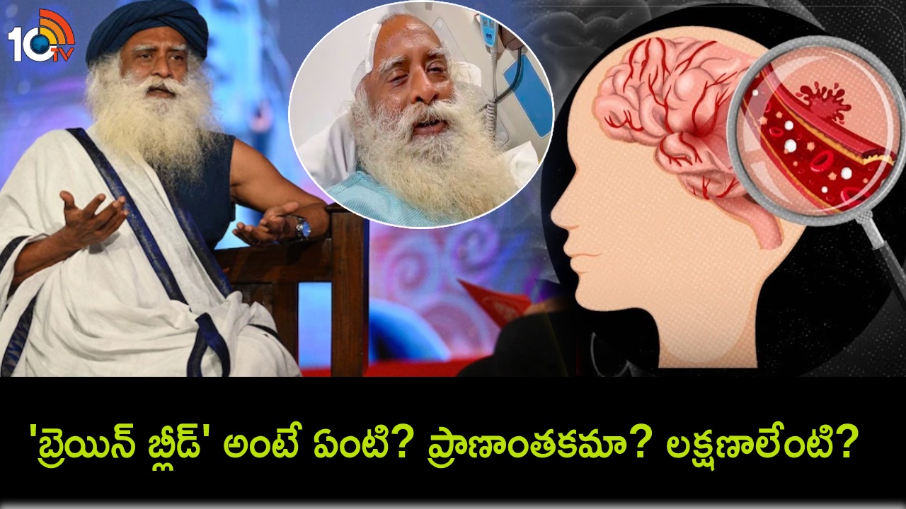 Brain Bleed Symptoms : ‘బ్రెయిన్ బ్లీడ్’ అంటే ఏంటి? సద్గురు ఈ పరిస్థితి నుంచి ఎలా కోలుకున్నారు? అసలు లక్షణాలేంటి? నివారణ ఎలా? Brain Bleed Symptoms : ‘బ్రెయిన్ బ్లీడ్’ అంటే ఏంటి? సద్గురు ఈ పరిస్థితి నుంచి ఎలా కోలుకున్నారు? అసలు లక్షణాలేంటి? నివారణ ఎలా?