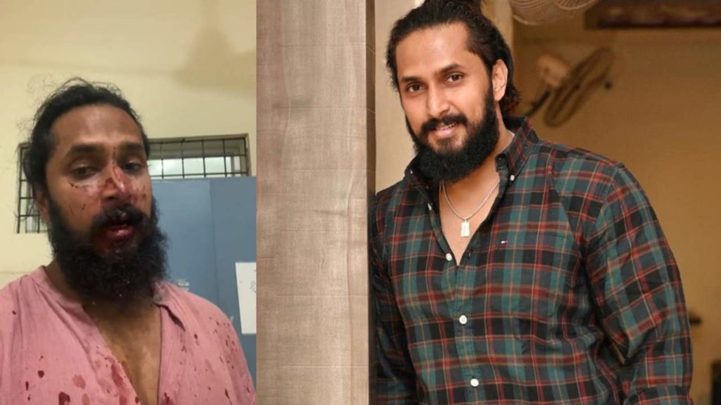 Some Persons attacked on Kannada Actor Chetan Chandra Issue goes Viral