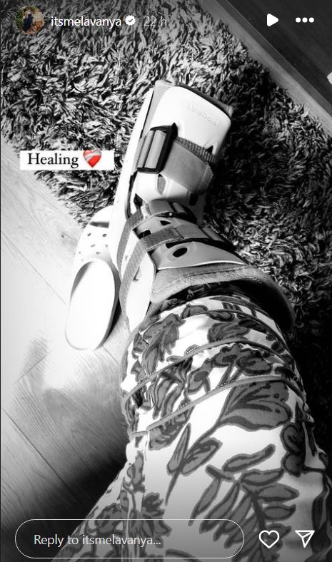 Lavanya Tripathi not attended to Pawan Kalyan Taking Oath Ceremony due to Leg Injury 