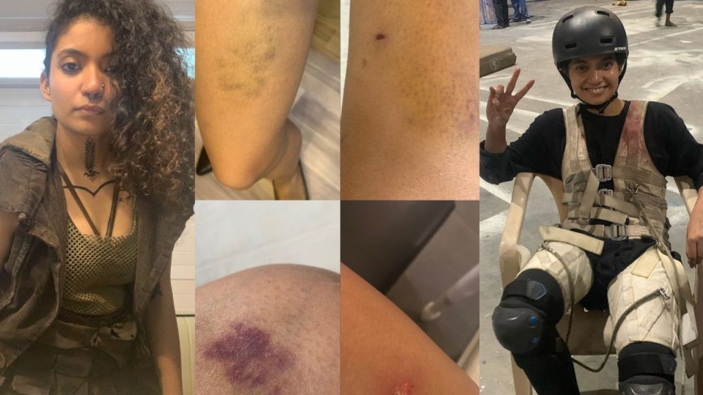 Anna Ben Injured in Prabhas Kalki 2898AD Movie while shooting Action Sequences Photos goes Viral