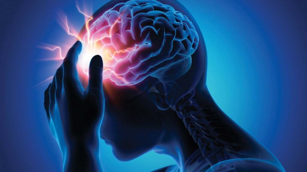 Brain Stroke