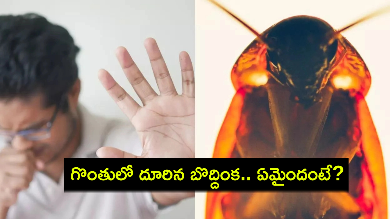 Cockroach Stuck Throat : నిద్రపోతున్న వ్యక్తి గొంతులో దూరిన బొద్దింక.. ఆ తర్వాత ఏమైందంటే? Cockroach Stuck Throat : నిద్రపోతున్న వ్యక్తి గొంతులో దూరిన బొద్దింక.. ఆ తర్వాత ఏమైందంటే?