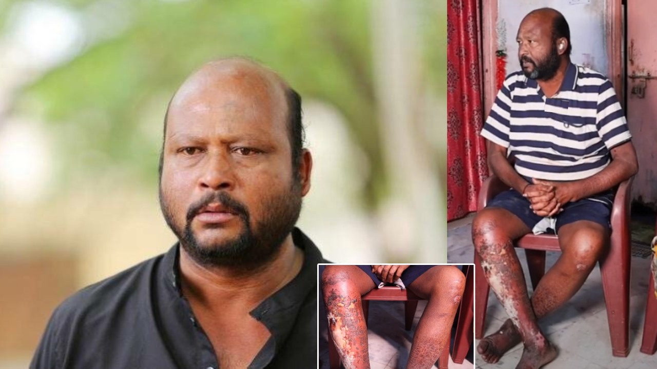 Fish Venkat : కమెడియన్ ఫిష్ వెంకట్.. ఇప్పుడు దయనీయ స్థితిలో.. కాళ్ళు పాడయి.. డబ్బులు లేక, కొడుకులు పట్టించుకోక.. Fish Venkat : కమెడియన్ ఫిష్ వెంకట్.. ఇప్పుడు దయనీయ స్థితిలో.. కాళ్ళు పాడయి.. డబ్బులు లేక, కొడుకులు పట్టించుకోక..