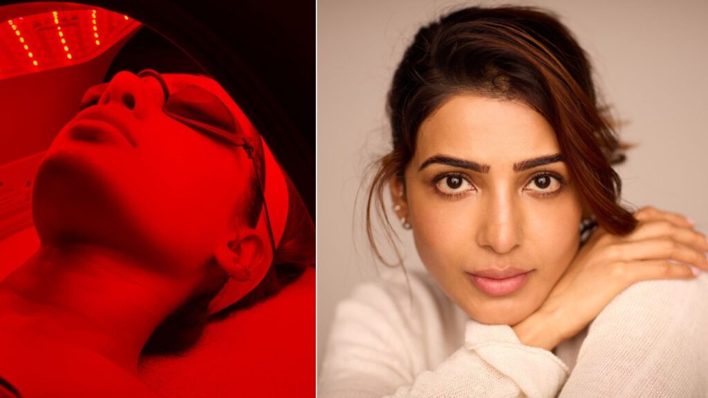 Samantha Shares a Post about her Skin Health Care Photos goes Viral