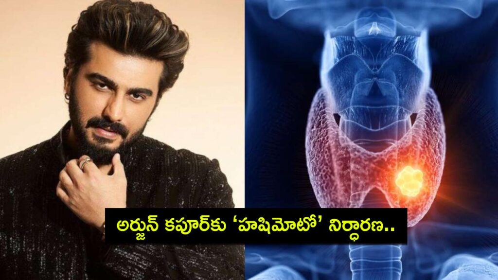 Arjun Kapoor is diagnosed with Hashimoto’s disease