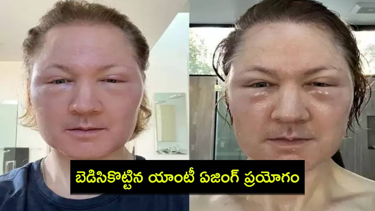 Bryan Johnson : యవ్వనం కోసం టెక్ బిలియనీర్ పాట్లు.. బెడిసికొట్టిన యాంటీ ఏజింగ్ ప్రయోగం..! Bryan Johnson : యవ్వనం కోసం టెక్ బిలియనీర్ పాట్లు.. బెడిసికొట్టిన యాంటీ ఏజింగ్ ప్రయోగం..!