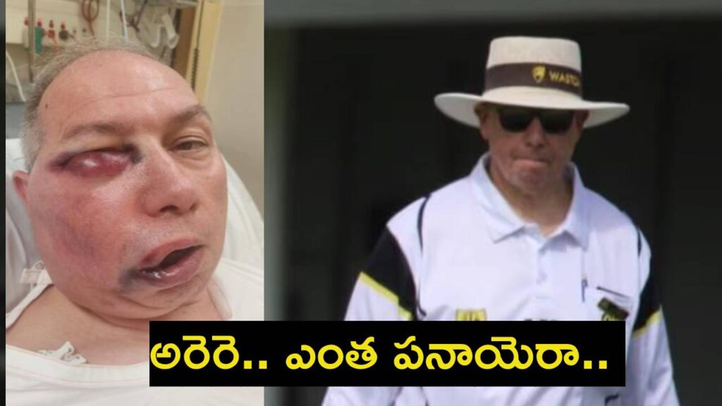 Tony de Nobrega Suffers Facial Injury after being hit by ball