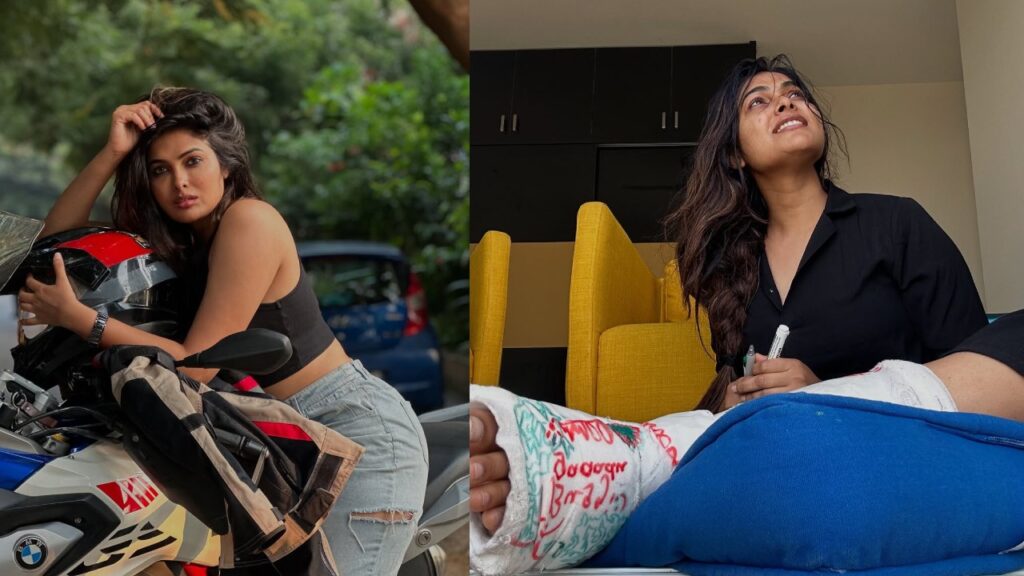 Actress Divi Shares Photos with Injured Leg Social Media Post goes viral