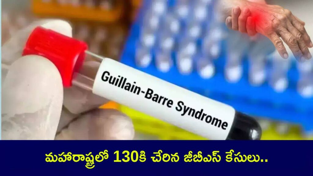 Guillain-Barre Syndrome