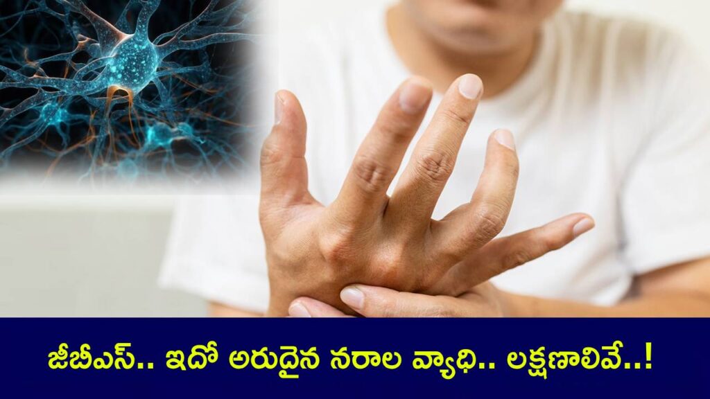 Guillain Barre Syndrome