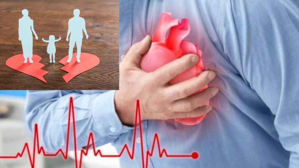 Stroke Risk
