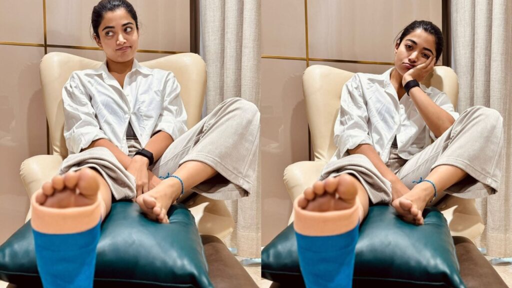 Rashmika Mandanna Shares her Injure Leg Photos and Tells about Incident